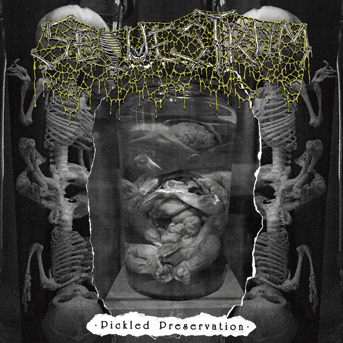 Sequestrum 'Pickled Preservation'